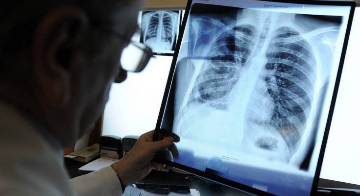 туберкулеза умер ребенок